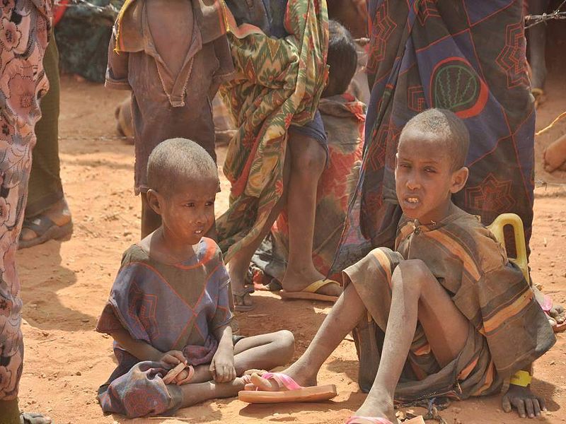 Malnourished children, weakened by hunger.jpg